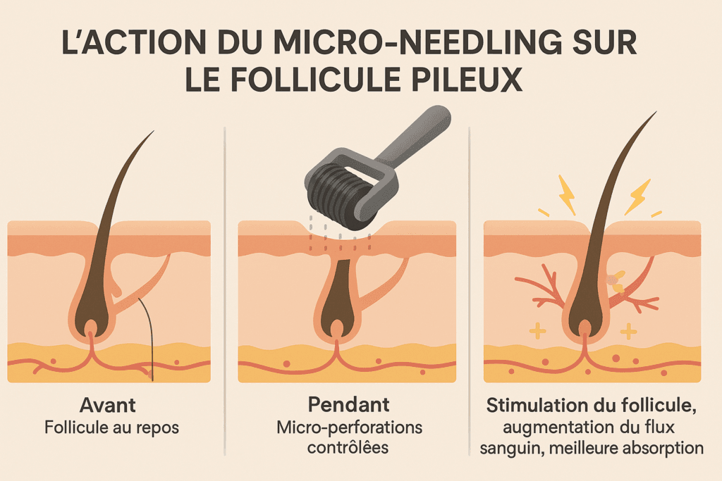 Infographie expliquant le mécanisme du dermaroller cheveux : comment le micro-needling stimule le follicule pileux, le flux sanguin et l'absorption des soins.