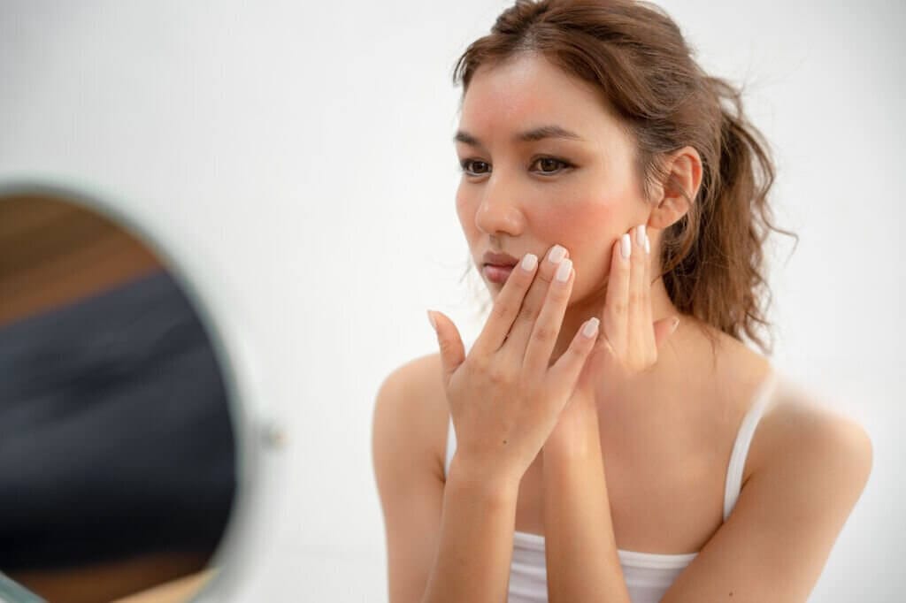 Une femme regardant son visage dans un miroir, montrant des signes de couperose et de rosacée avec des rougeurs sur les joues et le nez